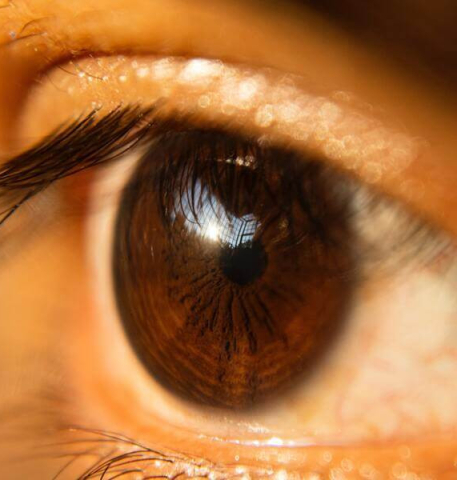 How Eyelid Surgery Can Enhance Your Appearance