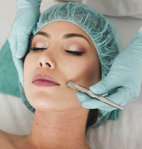 Microneedling Therapy: Advantages And Risks